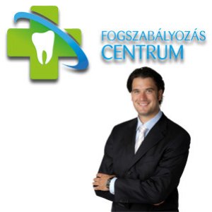 Fogszabályozás
